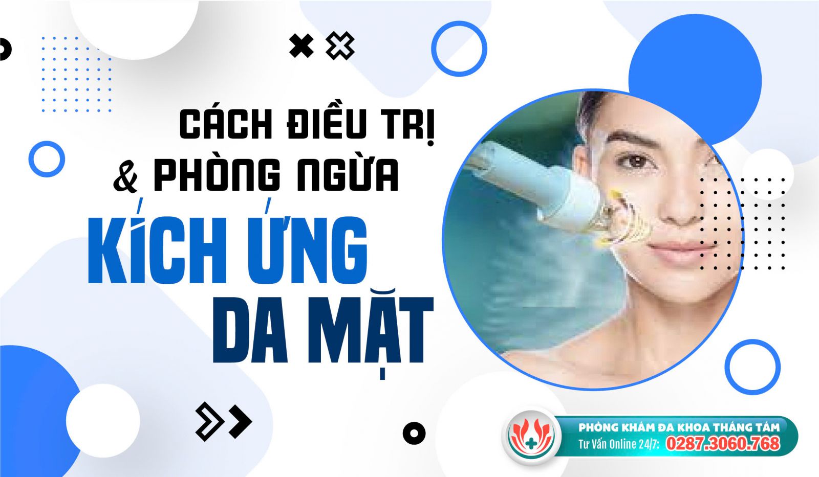 Phương pháp điều trị da mặt bị kích ứng an toàn và hiệu quả