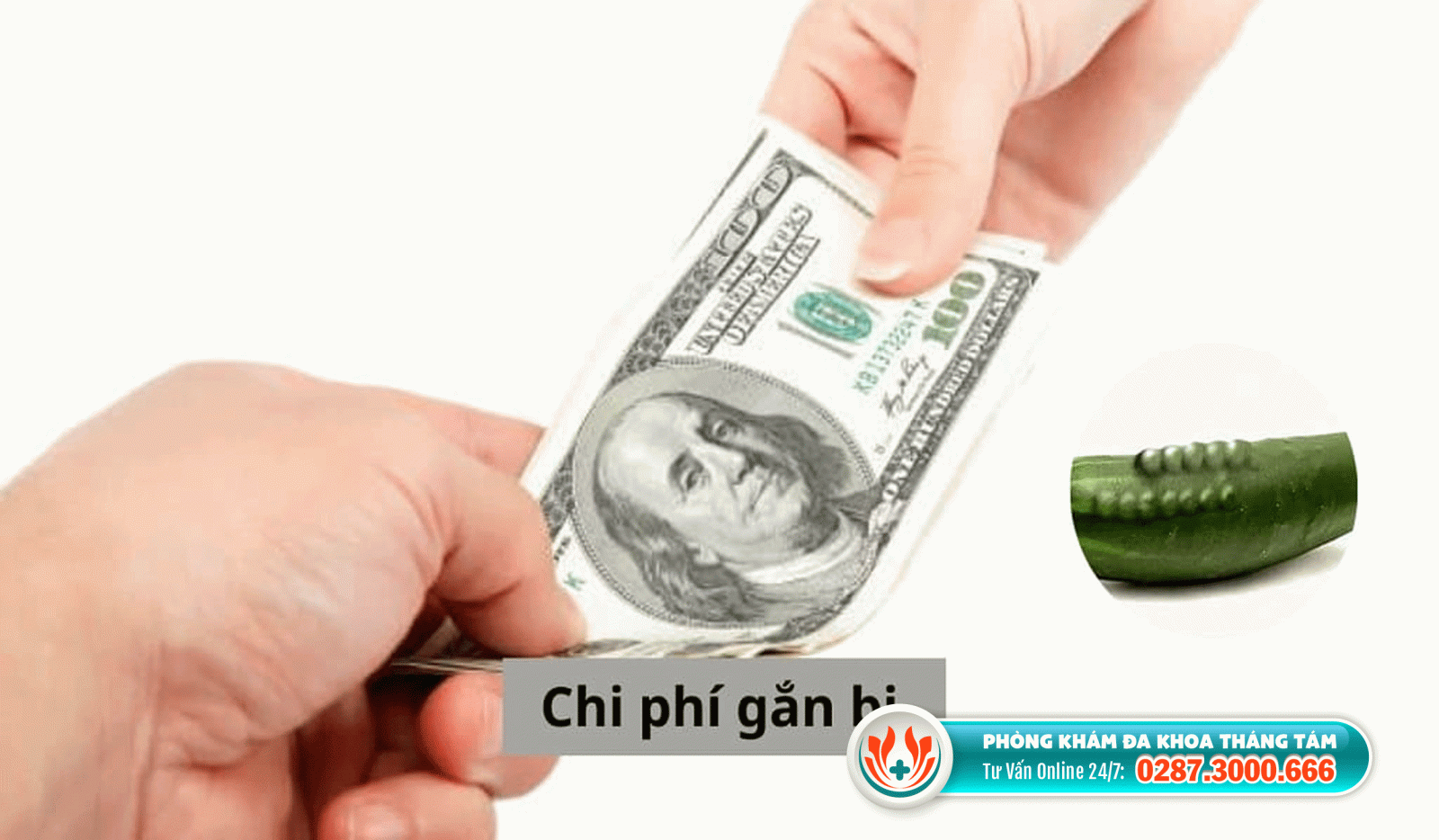 Các yếu tố ảnh hưởng đến chi phí gắn bi dương vật