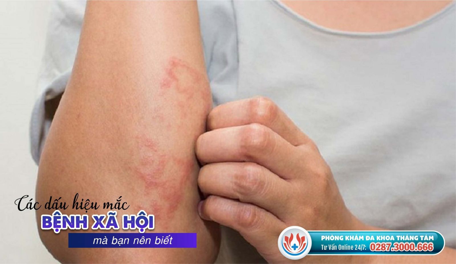 Nhận biết dấu hiệu mắc bệnh xã hội 