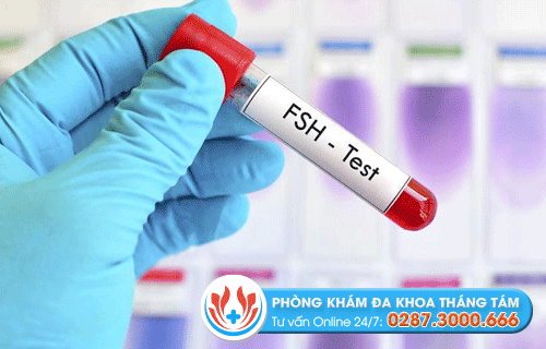 FSH test - Phương pháp chẩn đoán tình trạng tắc ống dẫn tinh ở nam