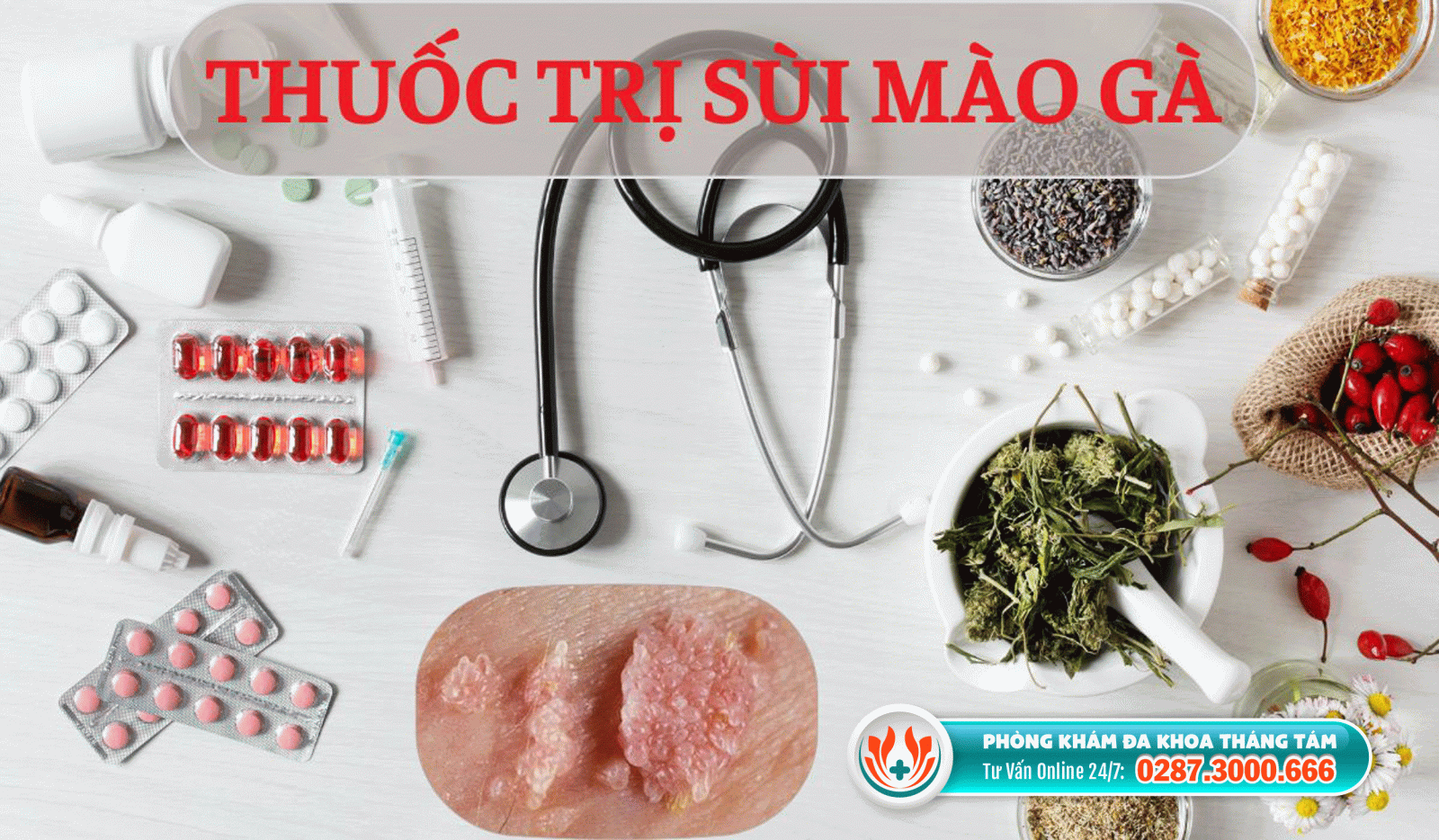 Giá thuốc trị sùi mào gà là bao nhiêu?