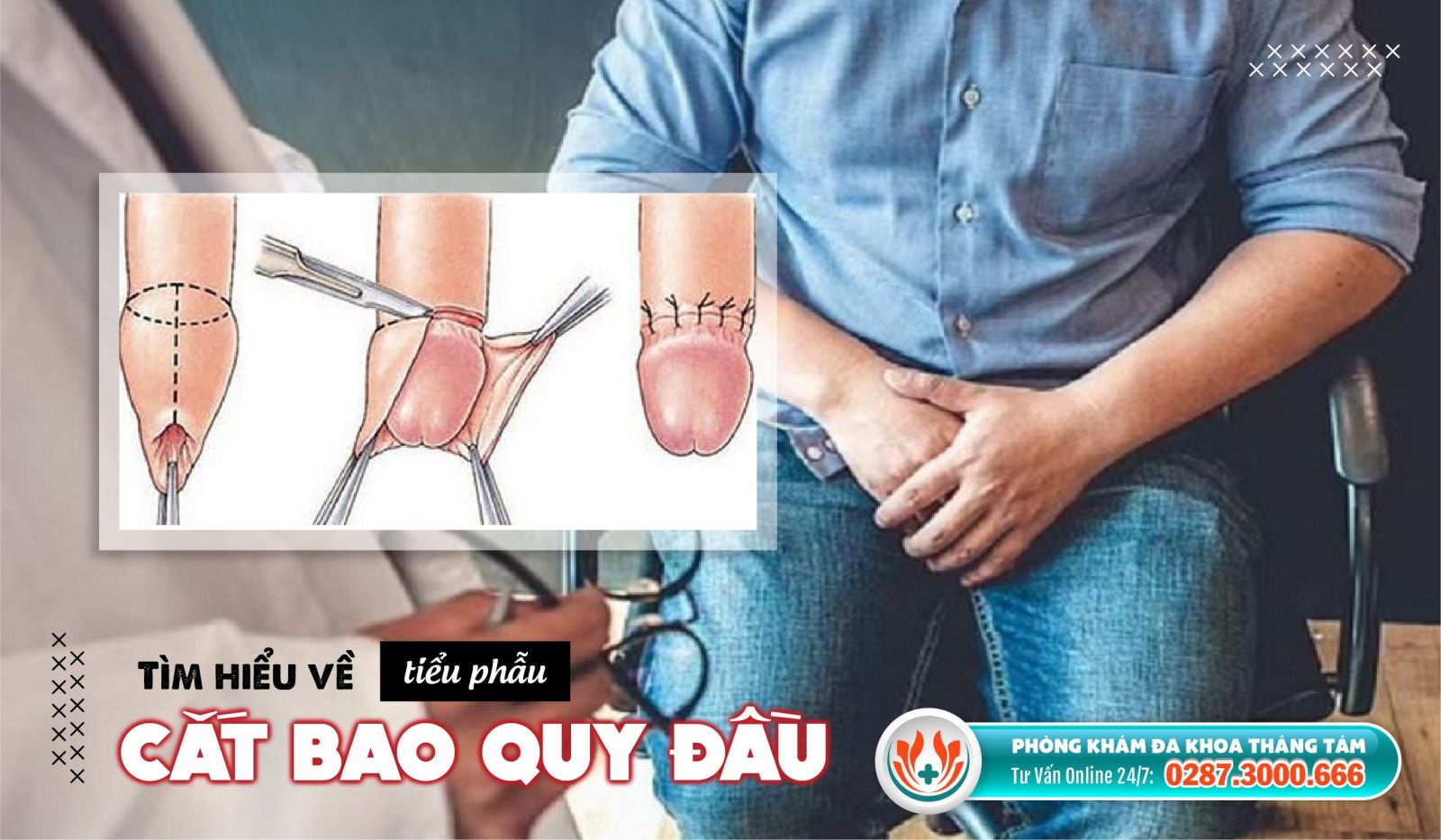 Tìm hiểu về thủ thuật cắt bao quy đầu 